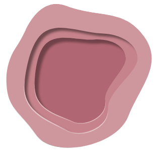 Diabetic Foot Ulcer Illustration